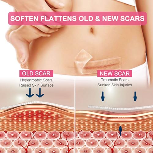 Silicone Scar Sheets, Clear Silicon Gel Scar Sheets, Invisible Scar Tape(1.6” x 120”Roll-3M), Scar Strips for Surgical Scars, Medical Grade, Scar Removal Sheets for C-Section, Breast, Keloid et.