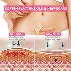 Silicone Scar Sheets, Clear Silicon Gel Scar Sheets, Invisible Scar Tape(1.6” x 120”Roll-3M), Scar Strips for Surgical Scars, Medical Grade, Scar Removal Sheets for C-Section, Breast, Keloid et.