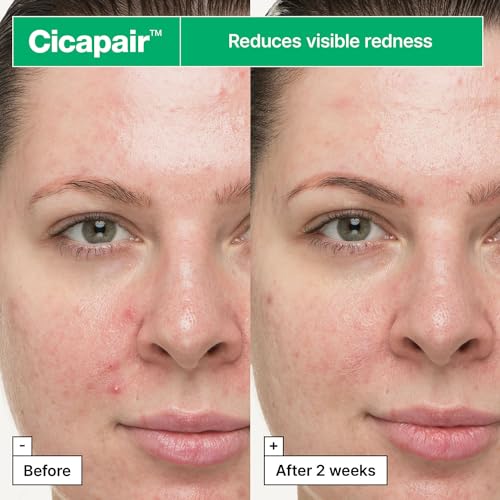 Dr.Jart+ Cicapair™ So Soothing Face Treatment for Visibly Irritated Skin with Centella Asiatica | Skin Barrier Repair | Korean Skin Care, 1.01 Fl Oz