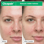 Dr.Jart+ Cicapair™ So Soothing Face Treatment for Visibly Irritated Skin with Centella Asiatica | Skin Barrier Repair | Korean Skin Care, 1.01 Fl Oz