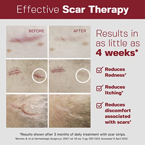 Physician Formulated Silicone Scar Sheets - Advanced Crosspolymer Medical Grade Silicone Scar Strips for Surgery, C Section, Keloids & Hypertrophic Scars - Silicone Tape For Scars (5 Sheets)