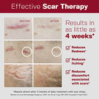 Physician Formulated Silicone Scar Sheets - Advanced Crosspolymer Medical Grade Silicone Scar Strips for Surgery, C Section, Keloids & Hypertrophic Scars - Silicone Tape For Scars (5 Sheets)