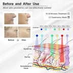Red-Light-Therapy-for-Face, 7 Color Light Therapy LED Face Mask SPA Equipment