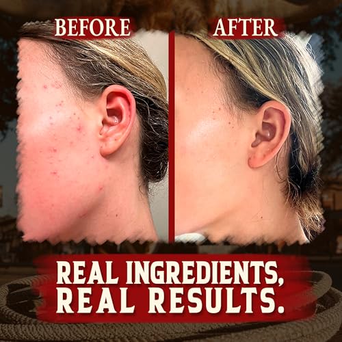 Wrath & Remedy Handmade Whipped Organic Beef Tallow for Skin - 4 OZ (Unscented) — Grass Fed Beef Tallow Moisturizer and Honey Balm for Silky, Sensitive-Skin, Eczema, Rosacea - Free of Harsh Chemicals