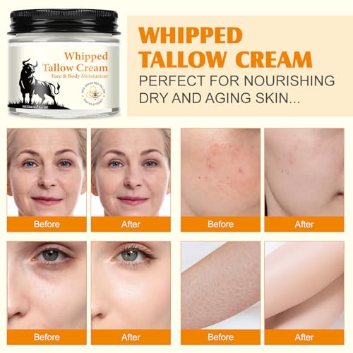 Beef Tallow for Skin, Beef Tallow, Organic Grass Fed Beef Tallow - Tallow and Honey Balm- Deeply Moisturizing, All-Natural Handmade Lotion Whipped Beef Tallow Face Moisturizer