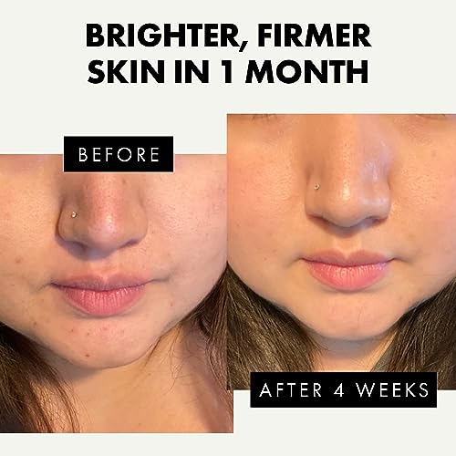 Eclat Skincare 3-Pack Face Serums - Vitamin C, Hyaluronic Acid, Retinol for Anti-Aging, Hydrating Care