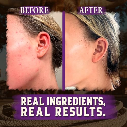 Wrath & Remedy Handmade Whipped Organic Beef Tallow for Skin - 4 OZ (Lavender) — Grass Fed Beef Tallow Moisturizer and Honey Balm for Silky, Sensitive-Skin, Eczema, Rosacea - Free of Harsh Chemicals