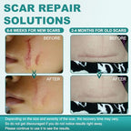 Silicone Scar Sheets, Silicone Scar Tape(1.6"x 79"), Professional Scar Removal Treatment, Reusable Silicone Scar Strips for Keloids, Surgeries Scars, C-sections, and Burns