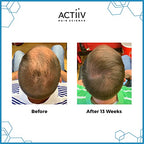 ACTIIV Recover Thickening Cleansing Hair Loss Shampoo Treatment for Men(Packaging May Vary)