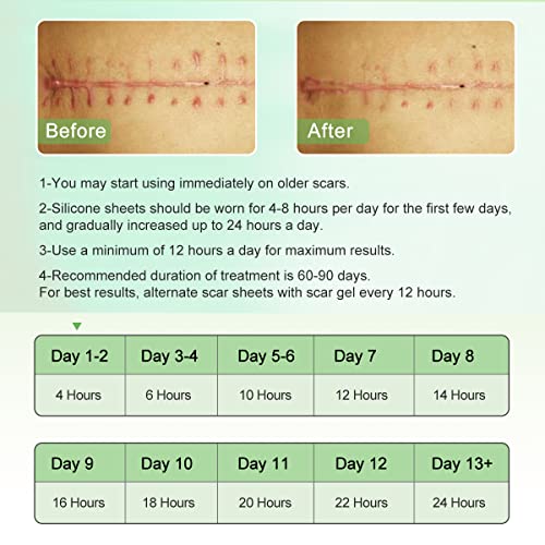 Silicone Scar Sheets, Tape, Strips, 16 Pcs 5.9"x1.6", Healing Keloid, C-Section, Tummy Tuck - As Surgical Cream, Gel, Patch, Bandage, Pad - Surgery Scars Treatment, Scar Remover.