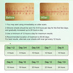 Silicone Scar Sheets, Tape, Strips, 16 Pcs 5.9"x1.6", Healing Keloid, C-Section, Tummy Tuck - As Surgical Cream, Gel, Patch, Bandage, Pad - Surgery Scars Treatment, Scar Remover.