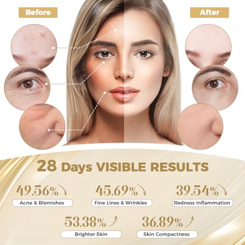 Red Light Therapy for Face, LED Face Mask Light Therapy, Red Light Therapy Mask for Acne, Wrinkles and Skin Rejuvenation, 320 LEDS, 3 Modes, 10-Min Auto Off, Eye Protection Included