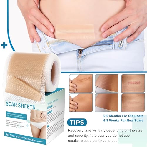 Silicone Scar Sheets, Silicone Scar Tape(1.8”x 157” Roll-4M), Silicone Scar Strips, Professional Scar Removal Sheets for Surgical Scars, Keloid, C-Section, Burn et