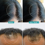 Pilgrim Advanced Hair Growth Serum | with 3% Redensyl + 4% Anagain | Stops Hair Loss & Hair Thinning | Hair Growth Treatment | Provides Thick & Dense Hair | 1.01 Fl Oz (30ml)