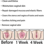 Weabet Instant Anti-Itch Detox Slimming Products, Natural Detox Viginal Capsulesa, Natural Detox Viginal Gel (8Bag)