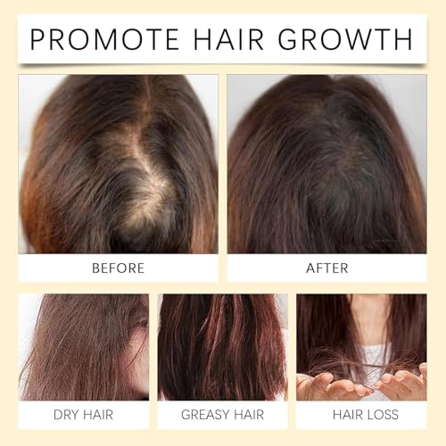 Batana Oil for Hair Growth, 4-in-1 Liquid Batana Oil, 100% Organic Batana Oil from Honduras with Rosemary with Rosemary, Pumpkin Seed Oil, Castor Oil for All Hair Types 30ml / 1 Fl Oz (1PCS)