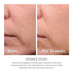 Epionce Renewal Facial Lotion - Hydrating, Anti-Aging Moisturizer for Normal to Combination Skin, For Fine Lines & Wrinkles, Dermatologist Skincare