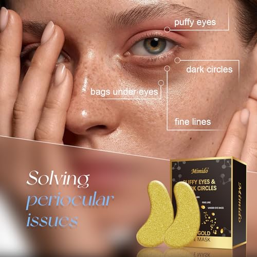 Mimido Under Eye Patches - Eye Patches for Puffy Eyes, eye masks for dark circles and puffiness (30 Pairs)