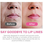 Anti Wrinkle Patches for Lip, Overnight Smoothing Wrinkles - Anti-Wrinkle Silicone Facial Patches for Lip, Fine Lines Wrinkle Patches for Smile Line & Lip Area