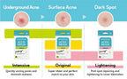 DERMA ANGEL Dark Spot Patches Blemish Patches with Hydrocolloid, TXA & CICA for Active Acne & Post-Inflammatory Dark Spots - Day and Night Use - UPGRADED (Post Acne - 96 Count - 1 Size)
