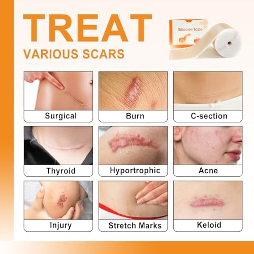 Carbou Silicone Scar Sheets (1.6"x 60"Roll) Medical Silicone Scar Tape Roll,Easy-Tear Soft Silicone Tape for Scars Removal,Reusable Painless Silicone Sheets for Surgery Scars, C-Section, Burn, Keloid