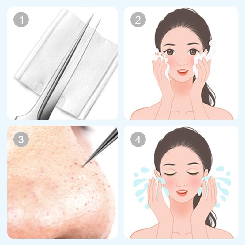 Medical Grade Blackhead Extraction Tool Kit - Blackhead Remover Tool Comedones Extractor Acne Removal Kit for Blemish - Whitehead Popping - 7 Pcs Set Removing for Nose Face Tools (Content 7-Piece Set)