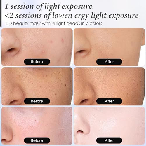 Red Light Therapy for Face, 7 Colors LED Face Mask Light Therapy At Home, Led Face Mask Light Therapy, Pink