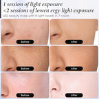 Red Light Therapy for Face, 7 Colors LED Face Mask Light Therapy At Home, Led Face Mask Light Therapy, Pink