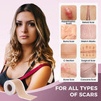 Silicone Scar Sheets - (1.6" x 120" Roll) Advanced Professional Medical Treatment for Scar Reduction, Painless Scar Removal Sheets for Surgical Scars, C-Section, Burns, Keloids
