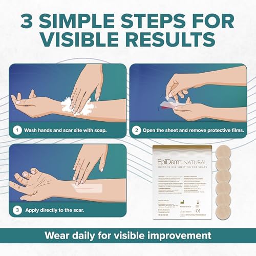 Epi-Derm Epi-Tab Circles Silicone Scar Sheets – Professional-Grade, Washable & Reusable Silicone Patches for Small Hypertrophic & Keloid Scars from Trauma, Liposuction & More - Natural, 6-Pack