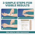 Epi-Derm Epi-Tab Circles Silicone Scar Sheets – Professional-Grade, Washable & Reusable Silicone Patches for Small Hypertrophic & Keloid Scars from Trauma, Liposuction & More - Natural, 6-Pack