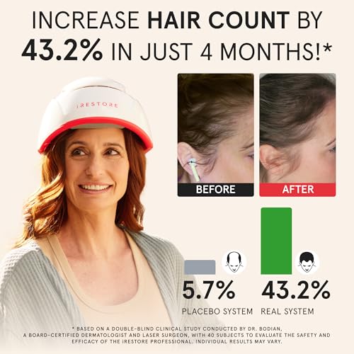 iRestore Professional + Rechargeable Battery Pack - Laser Red Light Therapy for Hair Growth - FDA Cleared Hair Loss, Thinning Treatment for Men & Women - Hair Regrowth Cap - 282 Lasers & LEDs