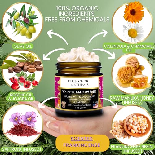 Whipped Tallow Balm - 100% Grass-Fed Beef Tallow, Pure Organic Moisturizer for Face & Body, Anti-Aging, Wrinkles, Fine Lines, Firming, Uneven Tone & Pigmentation - Handmade (2 Fl oz, Frankincense)