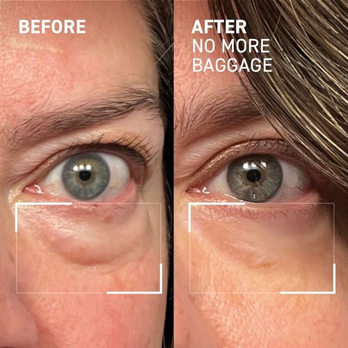 Dr. Brandt Needles No More, No More Baggage - Minimizes Under-Eye Bags, Puffiness & Dark Circles - 0.23 oz