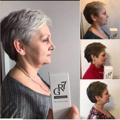 GR-7 Lotion for Grey Hair 125ml - 2 Pcs - Anti Grey Hair for Men and Women - Against Grey Hair - Away with Grey Hair