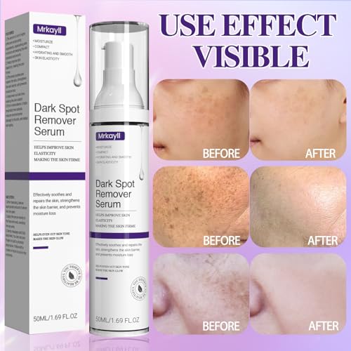 Advanced Dark Spot Remover for Face & Body - Effective Melasma & Hyperpigmentation Treatment - Fade Cream for Uneven Skin Tone - Suitable for All Skin Types - Natural Ingredients for Gentle Care