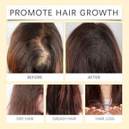 Batana Oil 4-In-1 Liquid for Hair Growth With Rosemary, Castor, and Pumpkin Seed Oil - 100ml/3.38 fl.oz