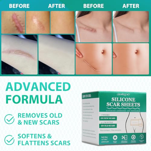 Silicone Scar Sheets, Medical Grade Silicone Scar Tape, Scar Removal Strips for Acne Scars C-Section & Keloid Surgery Scars Sheets Treatment Sheets -1.6"x 60" Roll-1.5M