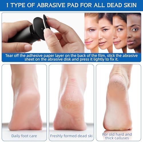 Electric Foot Filer-Electric Foot Callus Remover, Callus Remover for Feet, Dermave Electric Foot Callus Remover, 60pcs Snding Discs Dead Cracked Skin Calluses for Men/Women (Black)