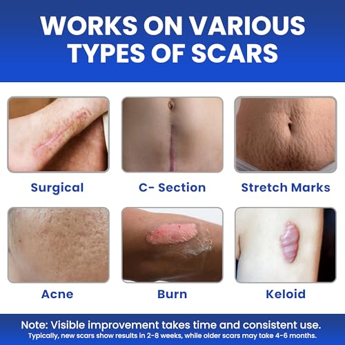 AWD Silicone Scar Sheets for Scar Removal - Extra Thick 0.5mm Silicone Scar Tape for Surgical Scars, C Section, Keloid - Silicone Skin Patches Extra Thick 0.5mm Longer Use (5 Pcs, 1.6” x 6”), Clear