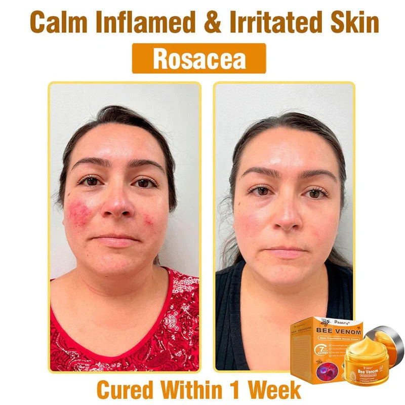 Daasry Bee Venom Skin Treatment Serum Cream, 2025 New Professional Bee Venom Skin Treatment Cream, Daasry Skin Repair Cream, Repair, moisturize and lift 3 in 1, for All Skin Types (3 Bottle)