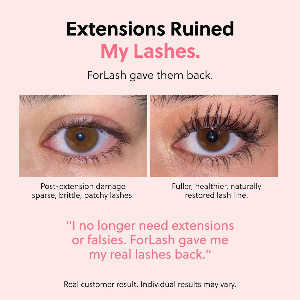 ForChics Prostaglandin-Free Eyelash Growth Serum – Rebuilds Thin Lashes