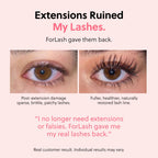 ForChics Prostaglandin-Free Eyelash Growth Serum – Rebuilds Thin Lashes