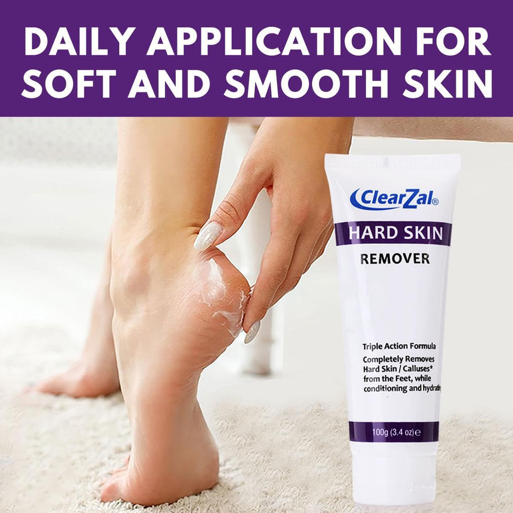 Clearzal Foot Cream For Hard Skin, Helps Calluses and Corn Removal While Leaving Soft Smooth Skin, Hydrating and Conditioning Triple Action Formula With Aloe Vera, 3.4 Ounce Tube