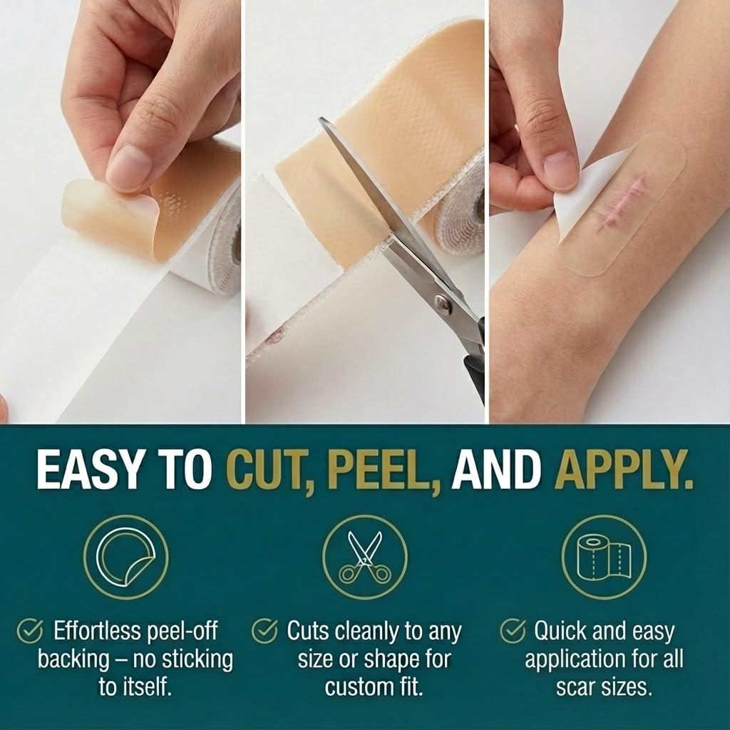 VLXO Silicone Scar Tape Roll (60" x 1.6") for Surgical & C-Section Scars