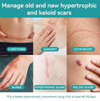 Dimora Medical Grade Silicone Scar Sheets - Ultra Soft Silicone Scar Tape (1.6”x120" Roll), Waterproof Scar Treatment for Surgical Scars, C Section, Tummy Tuck, Keloid Treatment
