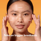 Mighty Patch™ Face Patch from Hero Cosmetics - XL Hydrocolloid Face Mask for Acne, 5 Large Pimple Patches for Zit Breakouts on Nose, Chin, Forehead & Cheeks - Korean Skin Care (1 Count)
