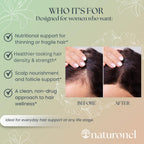Women's Balance Hair Growth Supplements, Ages 45 and Up - Supports Healthy Hair, Skin & Nails - Customer Proven for Visibly Thicker Hair and Scalp Coverage, Natural Thicker Hair Growth Supplement (1)