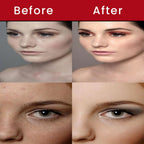 Bio Mystery Retinol Gel 0.025 Vitamin A Repairs Fine Lines & Wrinkles, Scar Treatment, Sun Spots, Anti-Aging Formula (35 Gram / 1.23 Oz)