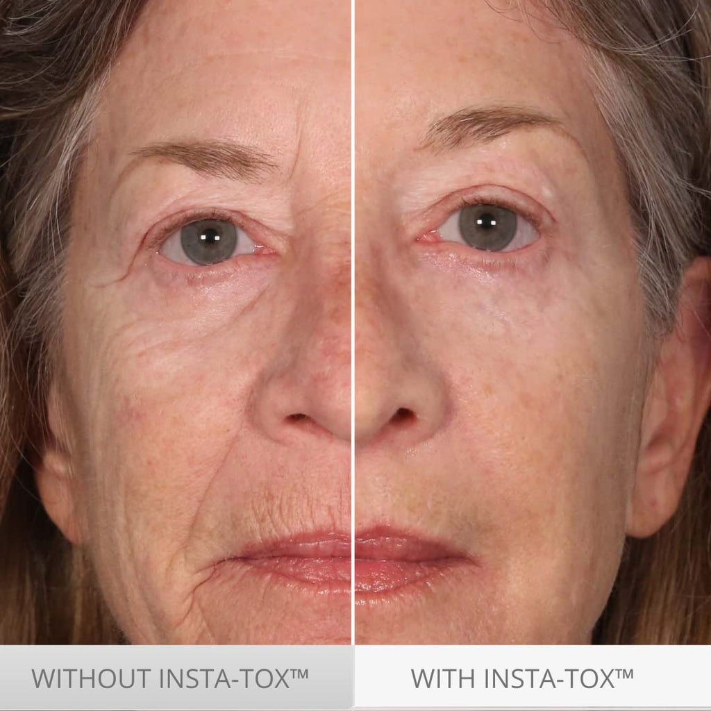 Serious Skincare - IMPROVES the appearance of deep wrinkles, fine lines, under eye bags, crow's feet, forehead and upper eyelid lines.